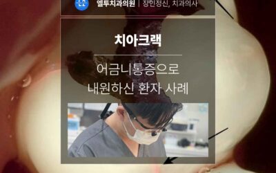 청담동치과에서 치아크랙을 진단하며 느낀 점을 공유드립니다