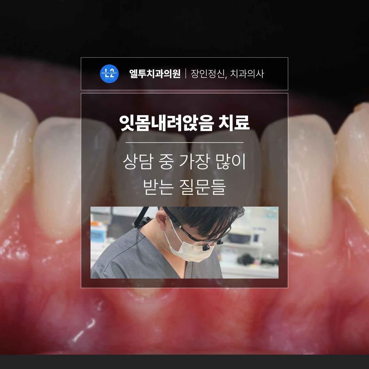 잇몸내려앉음 치료 상담에서 가장 많이 받는 질문들 잇몸내려앉음 치료와 관련된 상담 내용을 설명하는 치과 진료 장면