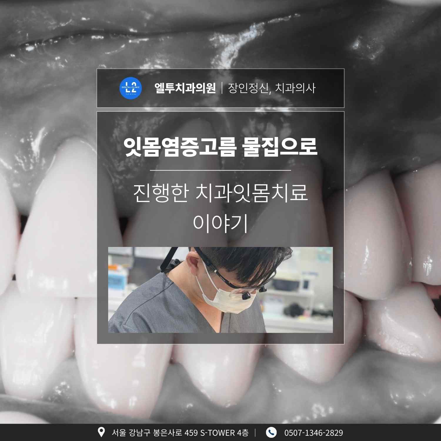 잇몸염증고름과 물집 증상으로 진행한 치과잇몸치료 사례 소개 이미지