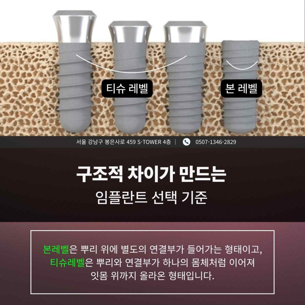 본레벨과 티슈레벨 임플란트의 구조적 차이를 비교한 삽화 이미지