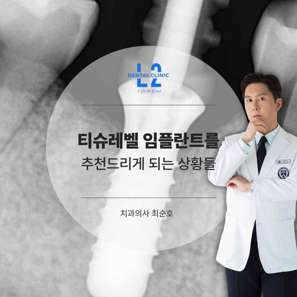 티슈레벨 임플란트를 추천하는 상황을 설명하는 원장 프로필 이미지