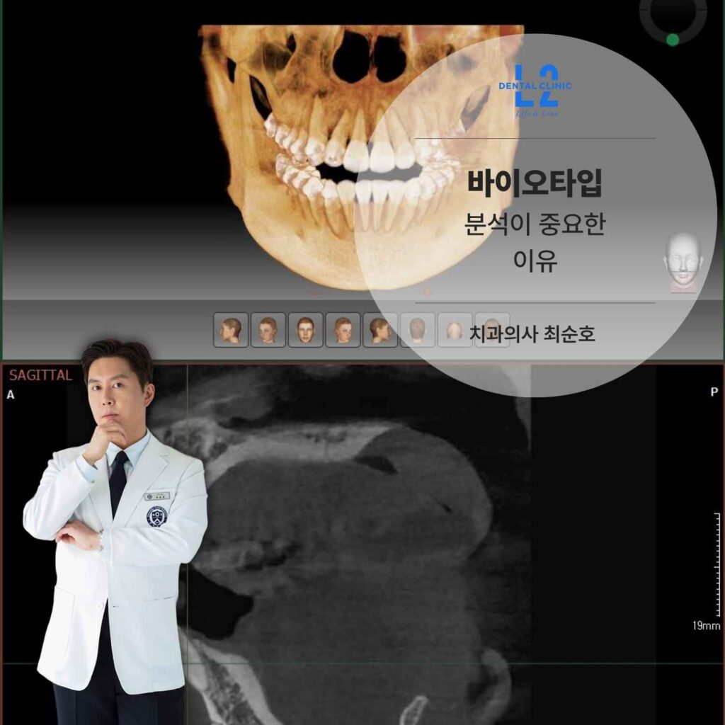 CT 영상을 통해 확인한 잇몸과 잇몸뼈 구조 분석 화면