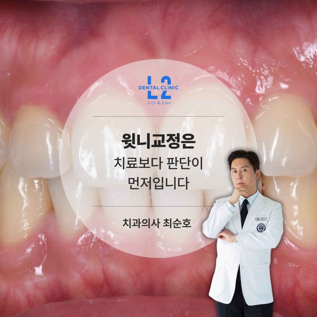 윗니교정은 치료보다 정확한 진단과 판단이 중요합니다