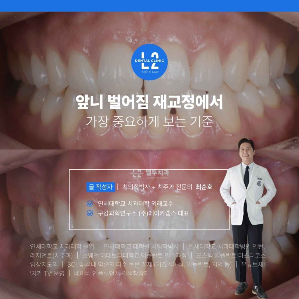 앞니 벌어짐 재교정에서 중요하게 고려한 치료 기준을 설명하는 이미지