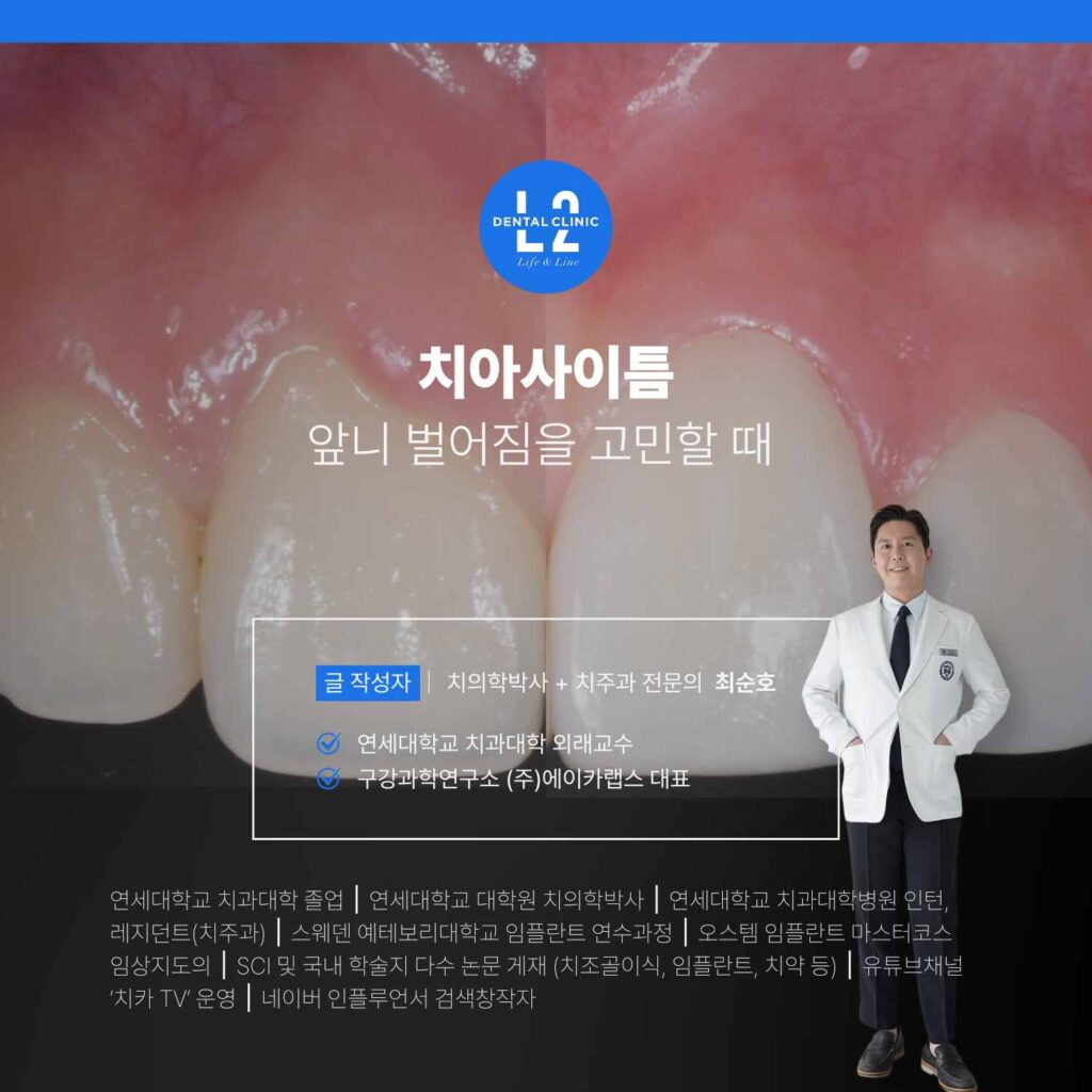 치아사이틈 복합 치료의 판단 기준을 설명하는 대표 이미지