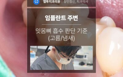 임플란트 주변 잇몸뼈 흡수 판단 기준 (고름/냄새)