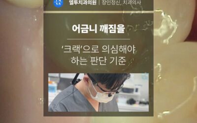 어금니 깨짐을 ‘크랙’으로 의심해야 하는 판단 기준
