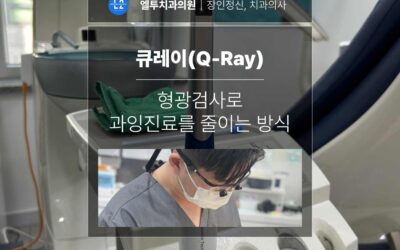 큐레이(Q-Ray) 형광검사로 과잉진료를 줄이는 방식