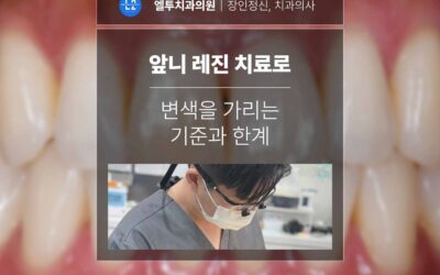 앞니 레진 치료로 변색을 가리는 기준과 한계