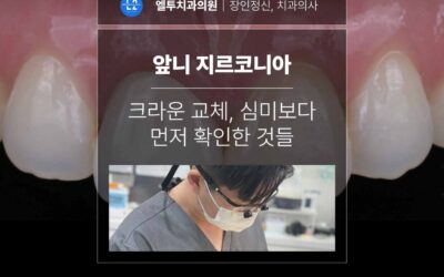 앞니 지르코니아 크라운 교체, 심미보다 먼저 확인한 것들