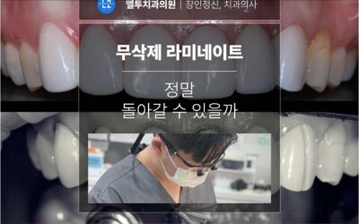 무삭제 라미네이트, 정말 돌아갈 수 있을까