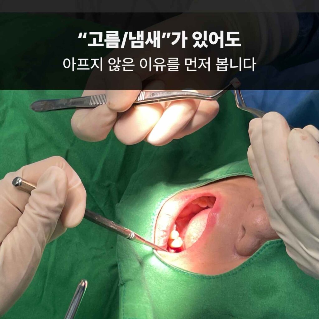 임플란트 주변 염증 평가와 처치를 설명하는 수술 장면 이미지