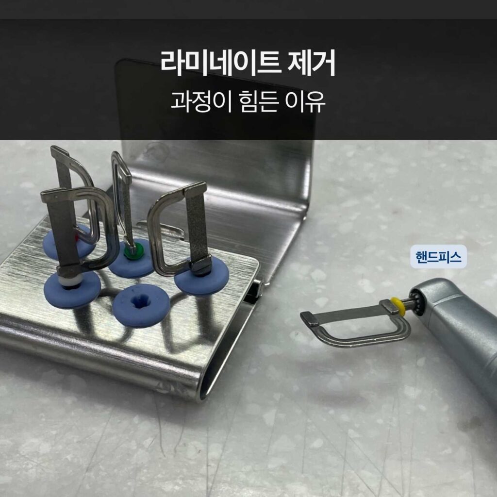 라미네이트 제거 시 사용되는 기구와 제거 과정의 어려움을 보여주는 이미지