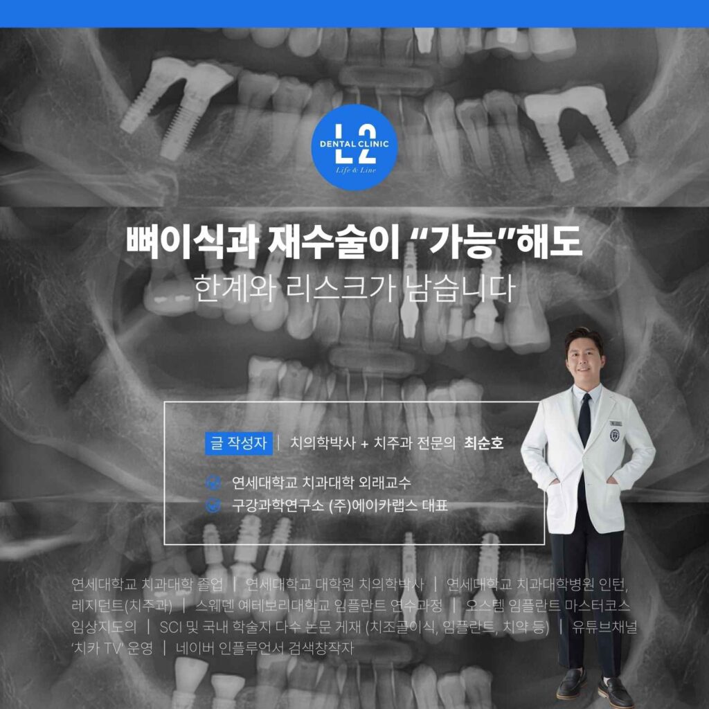뼈이식과 임플란트 재수술의 한계와 리스크를 설명하는 파노라마 배경 이미지