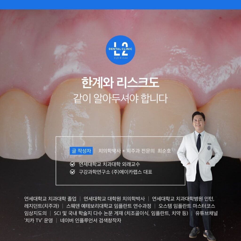 자연스러운 앞니 보철 사진 배경에 ‘한계와 리스크도 같이 알아두셔야 합니다’와 작성자 정보가 들어간 카드