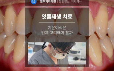 잇몸재생 치료와 치은이식은 언제 고려해야 할까