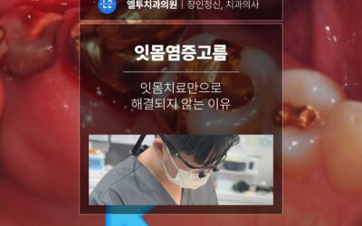 잇몸염증고름이 생겼을 때 잇몸치료만으로 해결되지 않는 이유