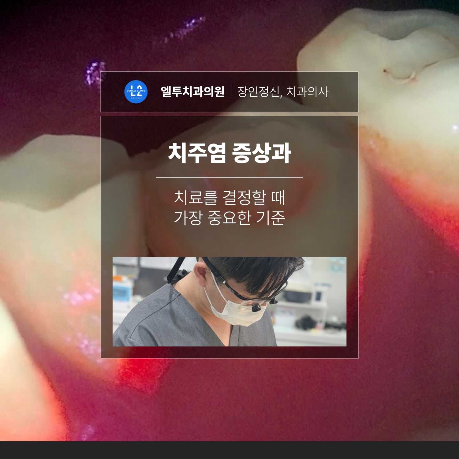 치주염 증상과 치료를 결정할 때의 기준 치주염 증상과 치료 판단 기준을 설명하는 엘투치과 대표 이미지