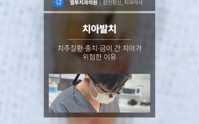 치아발치, 언제 해야 할까? 치주질환·충치·금이 간 치아가 위험한 이유