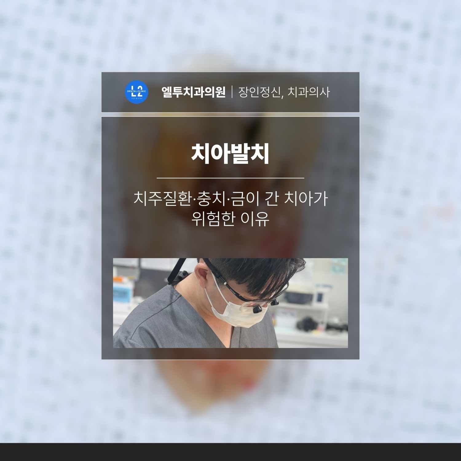 치아발치 치주질환 충치 금이간치아가 위험한 이유 치아발치와 치주질환 충치 금이간치아를 설명하는 대표 이미지