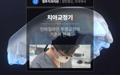 치아교정기, 인비절라인 투명교정의 기준과 한계