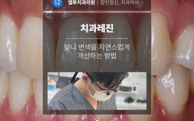 치과레진 앞니 변색을 자연스럽게 개선하는 방법