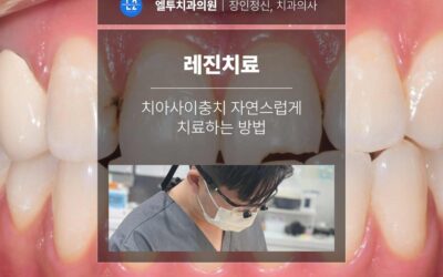 레진치료 치아사이충치 자연스럽게 치료하는 방법