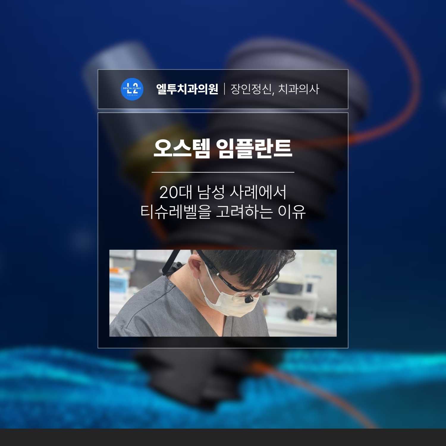 오스템 임플란트와 20대 남성 사례에서 티슈레벨 선택 기준을 설명하는 대표 이미지