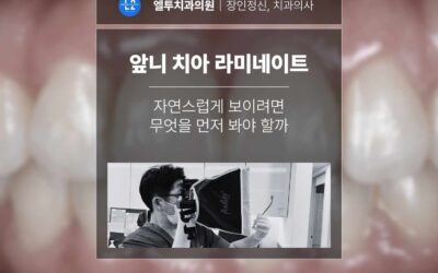 앞니 치아 라미네이트 자연스럽게 보이려면 무엇을 먼저 봐야 할까