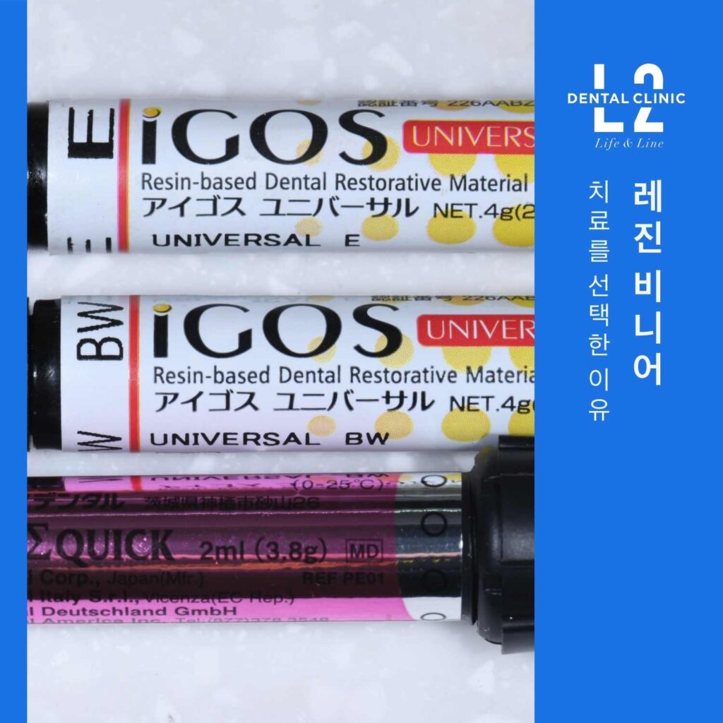 치과레진 비니어 치료에 사용되는 레진 재료 사진