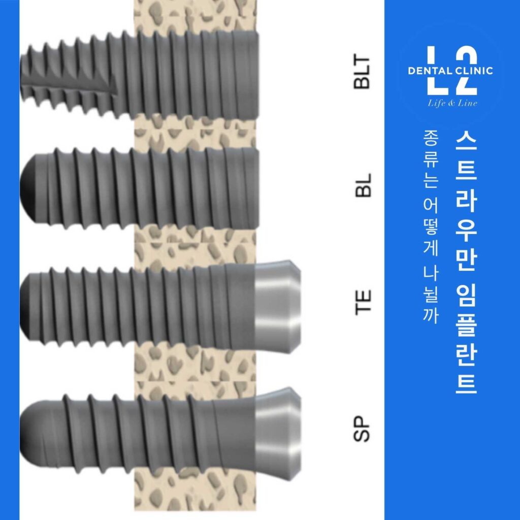 스트라우만 임플란트 종류 본레벨과 티슈레벨 비교 이미지