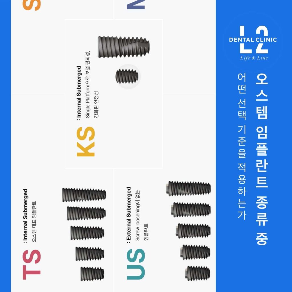 오스템 임플란트 종류 TS, US, KS 라인업 구조를 설명한 이미지